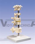 6 Mounted Vertebrae, atlas, axis, another cervical vertebra, two thoracic vertebrae with inter-vertebral discs and one lumbar vertebra